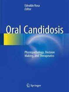 Oral Candidosis: Physiopathology, Decision Making, and Therapeutics