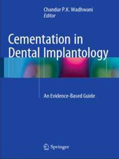 Cementation in Dental Implantology: An Evidence-Based Guide