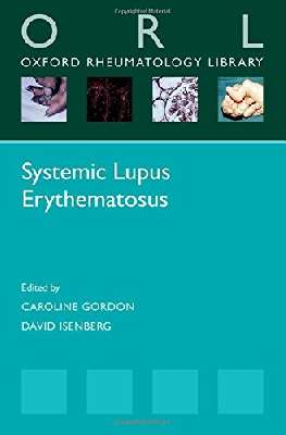 Systemic lupus erythematosus