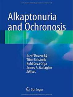 Alkaptonuria and Ochronosis