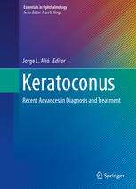 Keratoconus: Recent Advances in Diagnosis and Treatment