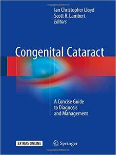 Congenital Cataract: A Concise Guide to Diagnosis and Management