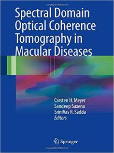 Spectral Domain Optical Coherence Tomography in Macular Diseases