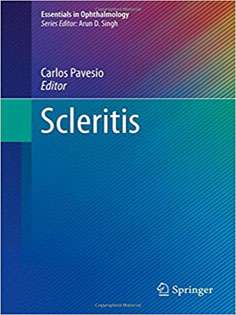 Scleritis (Essentials in Ophthalmology)