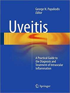 Uveitis: A Practical Guide to the Diagnosis and Treatment