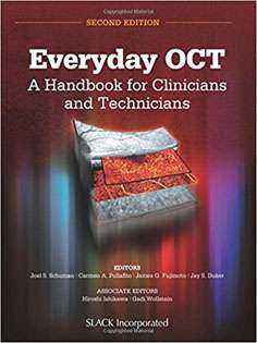 Everyday OCT: A Handbook for Clinicians and Technicians