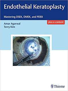 Endothelial Keratoplasty: Mastering DSEK, DMEK, and PDEK