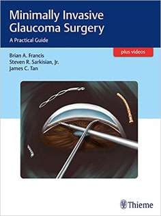 Minimally Invasive Glaucoma Surgery: A Practical Guide