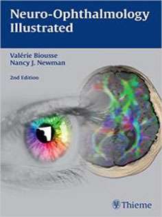 Neuro-Ophthalmology Illustrated