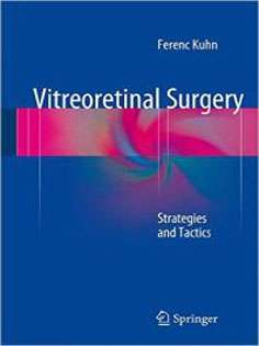 Vitreoretinal Surgery: Strategies and Tactics