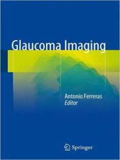 Glaucoma Imaging