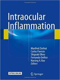 Intraocular Inflammation 2 Vol
