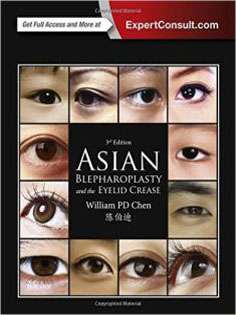 Asian Blepharoplasty and the Eyelid Crease