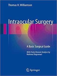 Intraocular Surgery: A Basic Surgical Guide