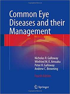 Common Eye Diseases and their Management