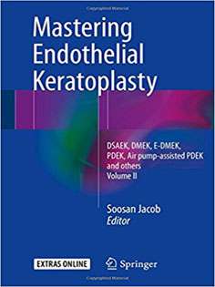 Mastering Endothelial Keratoplasty: Volume I