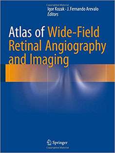 Atlas of Wide-Field Retinal Angiography and Imaging