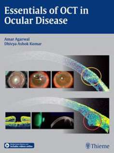 Essentials of OCT in Ocular Disease