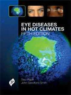 Eye Diseases in Hot Climates