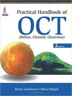 Practical Handbook of OCT - Retina, Choroid, Glaucoma