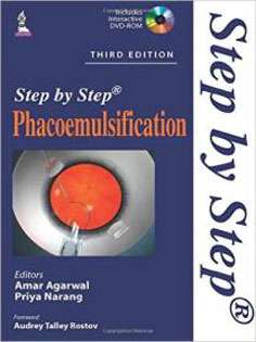 Phacoemulsification