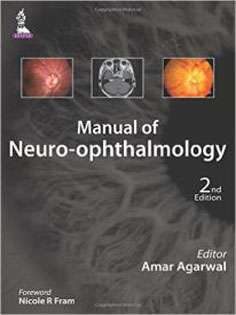 Manual of Neuro-ophthalmology