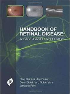 Handbook of Retinal Disease: A Case-Based Approach