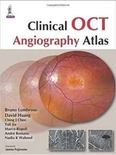 Clinical OCT Angiography Atlas