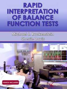 Rapid Interpretation of Balance Function Tests