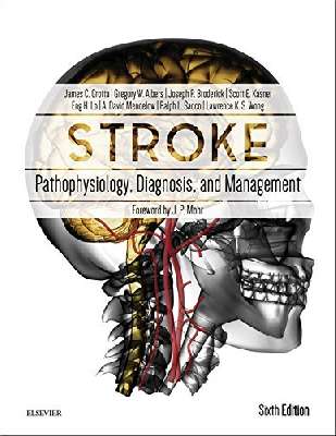 Stroke: Pathophysiology, Diagnosis, and Management, 6e