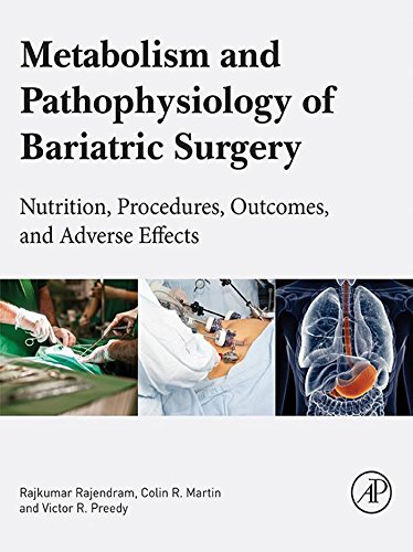 Metabolism and Pathophysiology of Bariatric Surgery. Nutrition, Procedures, Outcomes and Adverse Effects