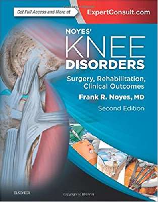 Noyes' Knee Disorders: Surgery, Rehabilitation, Clinical Outcomes, 2e