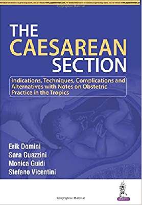 The Caesarean Section