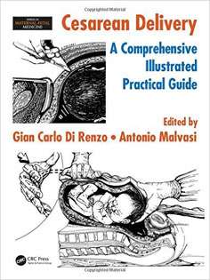 Cesarean Delivery: A Comprehensive Illustrated Practical Guide