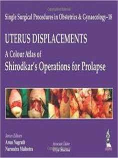 Uterus: Displacements: A Colour Atlas of Shirodkar's Operations For Prolapse