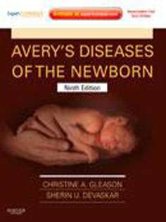 Avery's Diseases of the Newborn 2 Vol (black and white