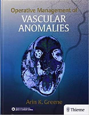 Operative Management of Vascular Anomalies