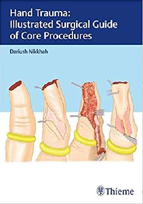 Hand Trauma: Illustrated Surgical Guide of Core Procedures