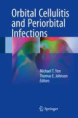 	Orbital Cellulitis and Periorbital Infections