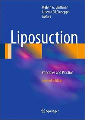 Liposuction: Principles and Practice