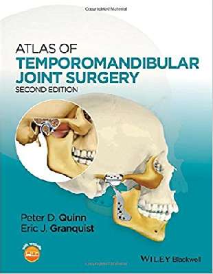 Atlas of Temporomandibular Joint Surgery