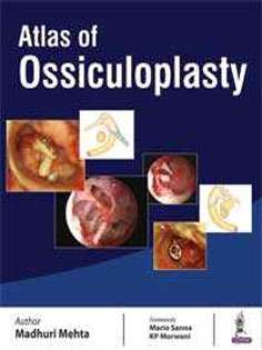 Atlas of Ossiculoplasty