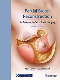 Partial Breast Reconstruction: Techniques in Oncoplastic Surgery