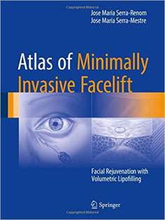 Atlas of Minimally Invasive Facelift