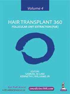 Hair Transplant 360: Follicular Unit Extraction (FUE) Volume 4