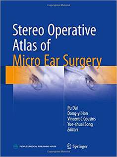 Stereo Operative Atlas of Micro Ear Surgery