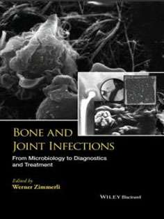 Bone and Joint Infections: From Microbiology to Diagnostics