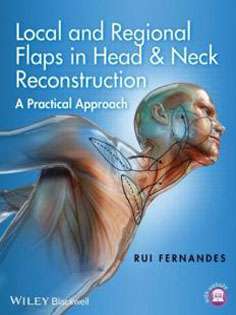 Local and Regional Flaps in Head & Neck Reconstruction