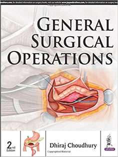 General Surgical Operations