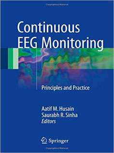 Continuous EEG Monitoring: Principles and Practice